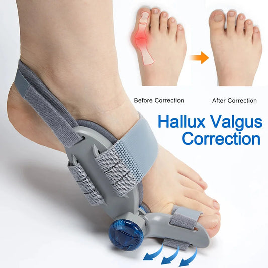Hallux Valgus Correction