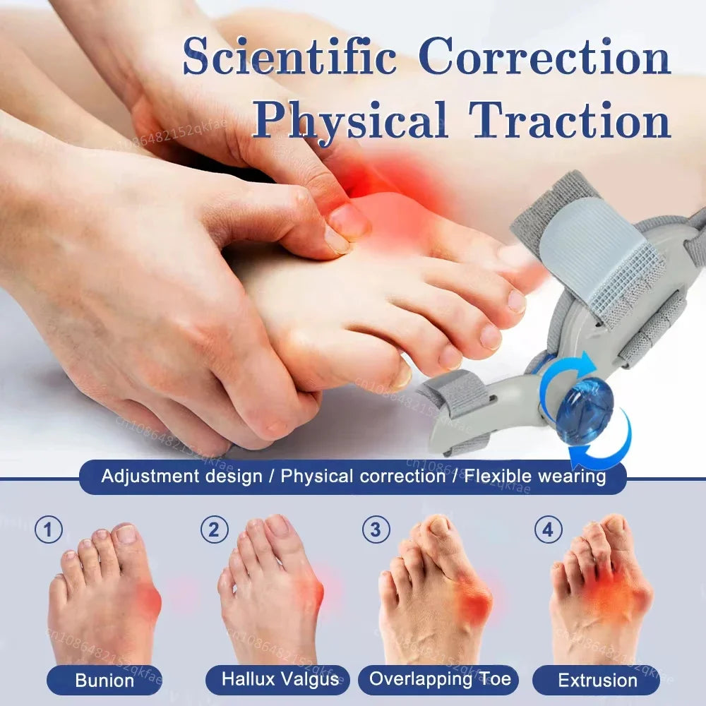 Hallux Valgus Correction